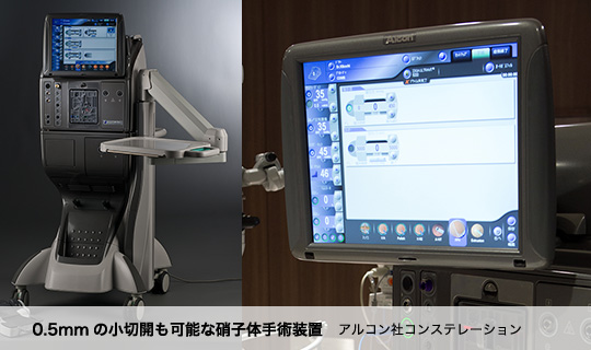 0.5mmの小切開も可能な硝子体手術装置 アルコン社コンステレーション